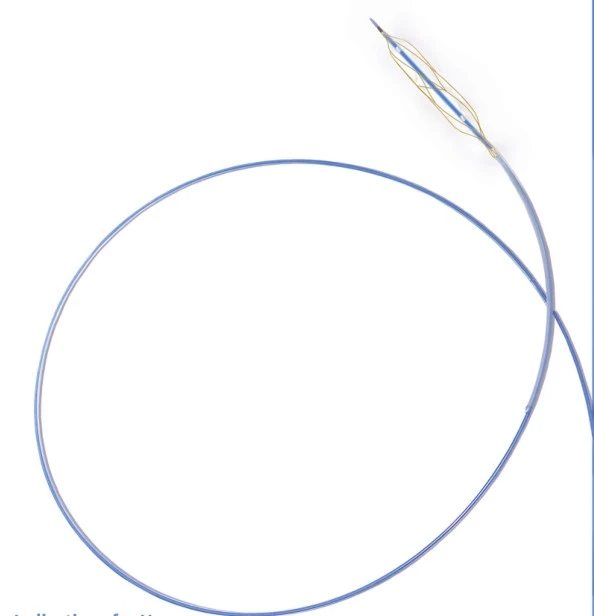 Scoring Pta Balloon